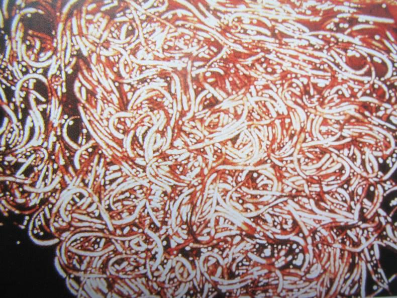 HANDS ON: Protecting foals from worms   